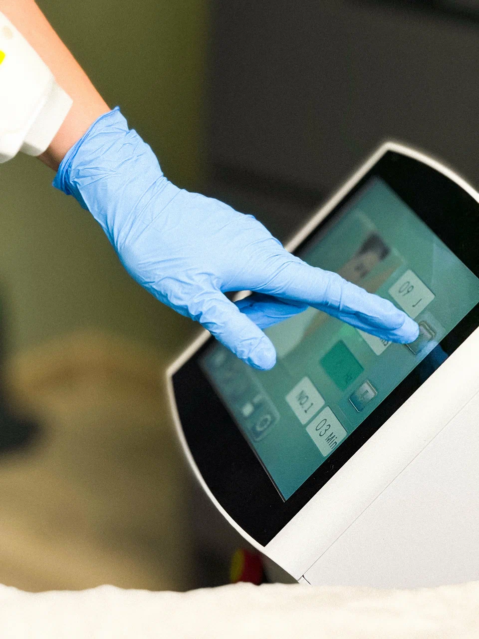 Индивидуальный подбор параметров лазерной эпиляции