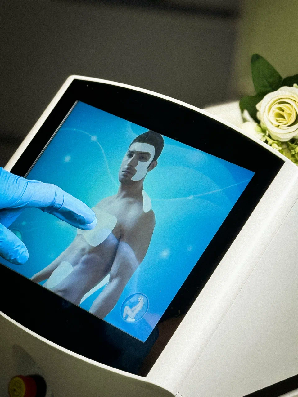 Профессиональное оборудование для лазерной эпиляции в студии Body Line